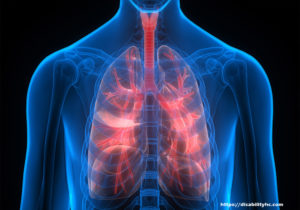 Chronic Obstructive Pulmonary Disease - What It Means for You
